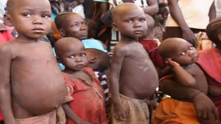 More Than 2 Million Children in Kano Affected by Stunting — UNICEF